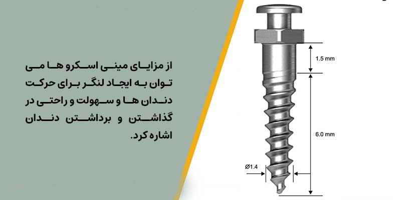 مینی اسکرو ارتودنسی