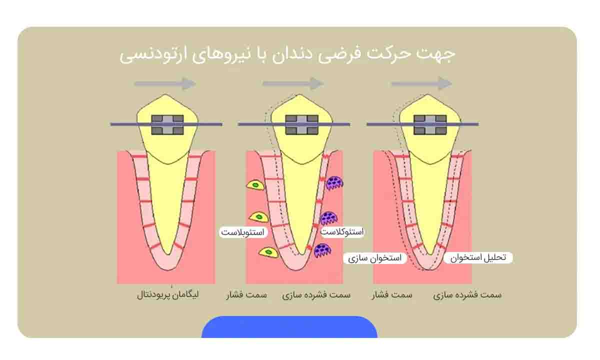 سیم ارتودنسی