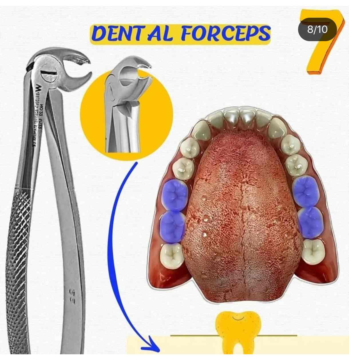 فورسپس مولر پایین