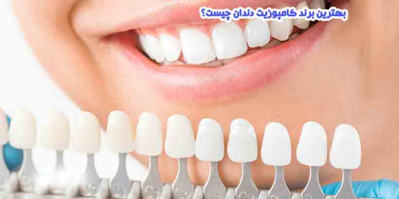 هر آنچه که باید درباره کامپوزیت های دندانپزشکی بدانید