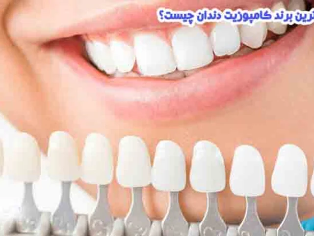 هر آنچه که باید درباره کامپوزیت های دندانپزشکی بدانید