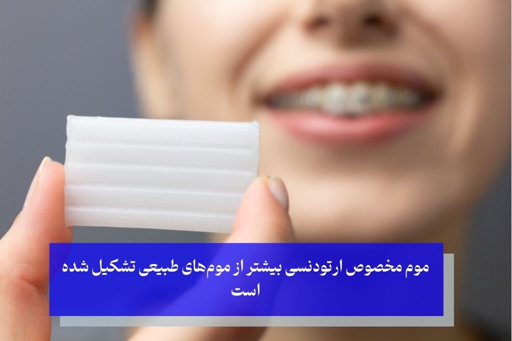 آموزش تصویری استفاده از موم ارتودنسی