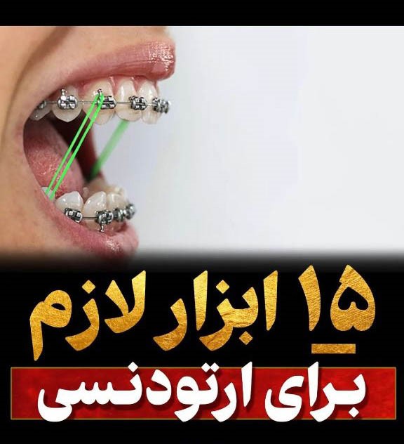 لیست وسایل مورد نیاز بیماران ارتودنسی در خارج از خانه