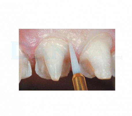 چگونه  با فرز سرامیکی لیفت لثه انجام دهیم؟