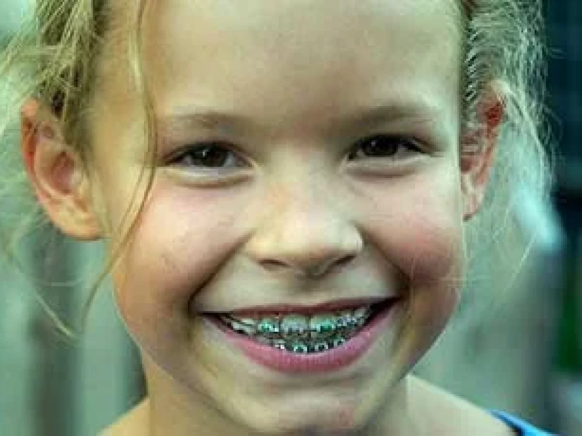 چگونه ارتودنسی را برای کودکان جذاب کنید؟