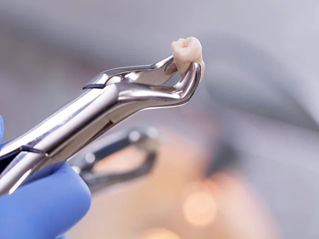 آموزش جامع تصویری ابزارهای کشیدن دندان