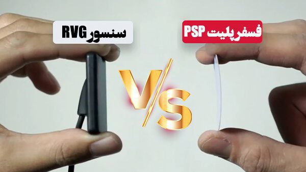 فسفرپلیت یا RVG؛ کدام دستگاه رادیوگرافی؟!مناسب کلینیک شماست؟