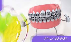 آشنایی با ابزارهای ارتودنسی