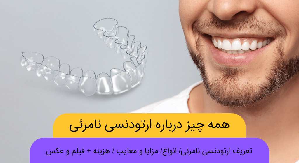 مراحل ارتودنسی نامرئی با الاینرهای شفاف