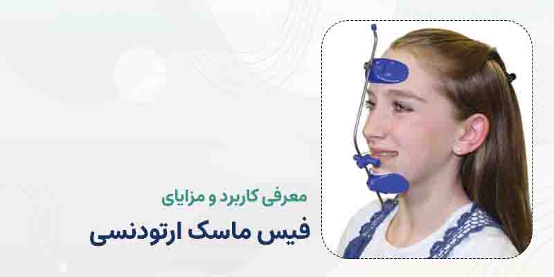 فیس ماسک ارتودنسی هر آنچه که باید درباره آن بدانید