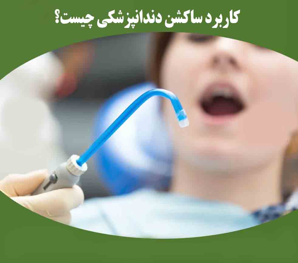 راهنمای جامع انتخاب ساکشن دندانپزشکی