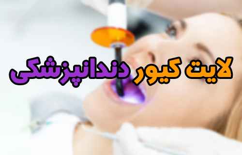 چگونه بهترین لایت کیور دندانپزشکی را خریداری نماییم؟