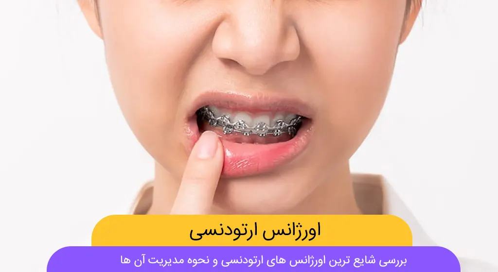 راهنمای حل مشکلات اورژانسی ارتودنسی