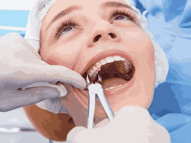 مراقبتهای بهداشتی بعد از خارج کردن دندان